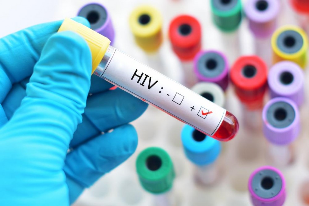 डेंटल क्लीनिक में भी हो सकता है एचआईवी